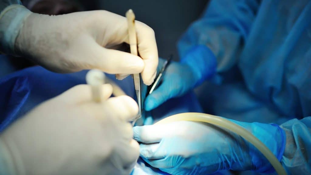 prescribed minimum benefits explained