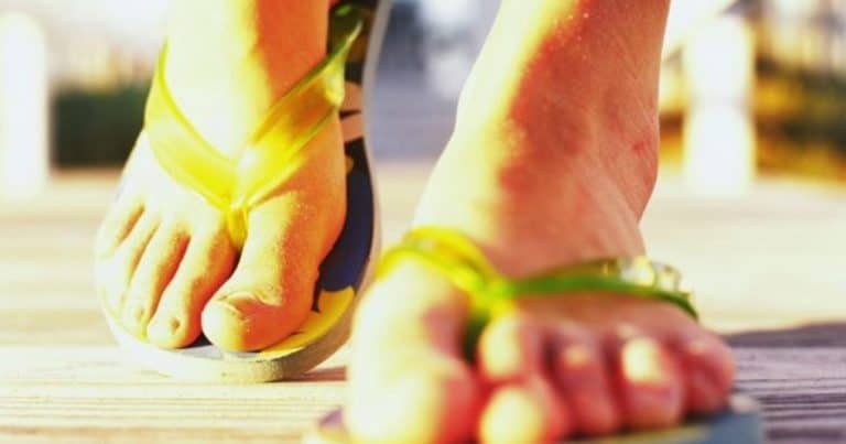 how bad are flip flops for your feet