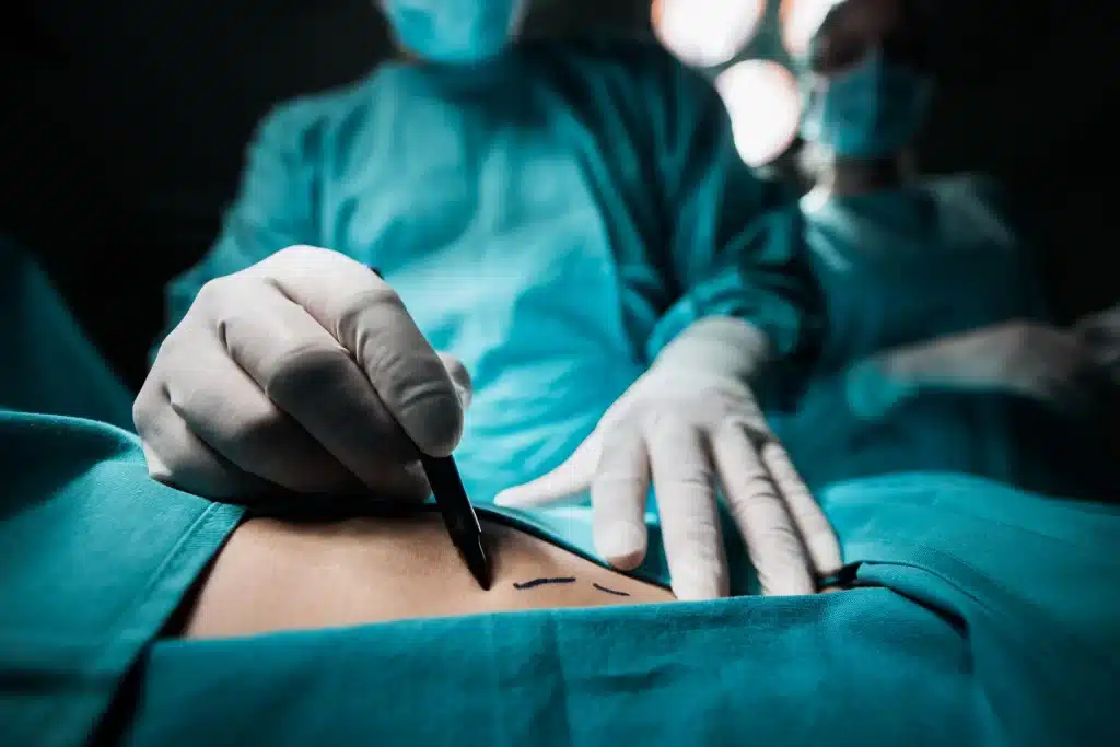 expensive private healthcare south africa